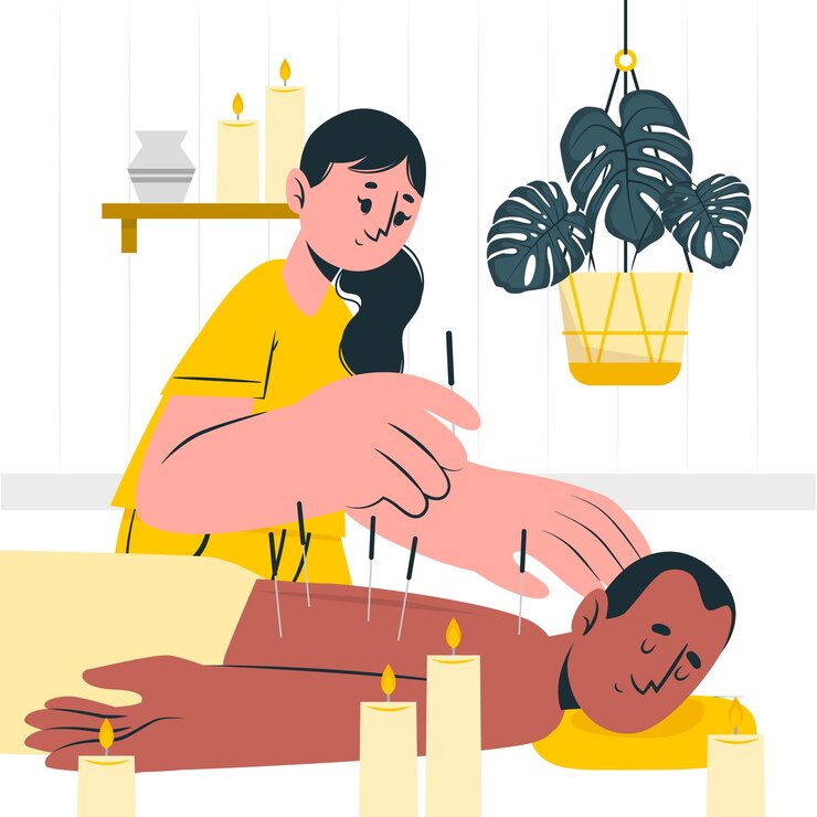Acupuncture